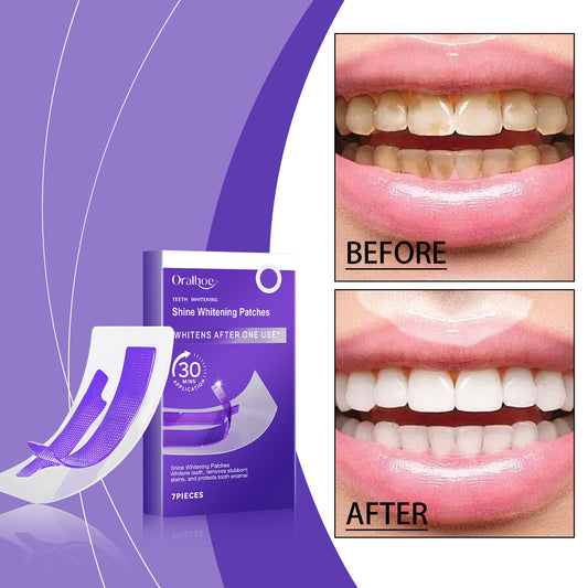 Whitening And Stain-Removing Teeth Strips